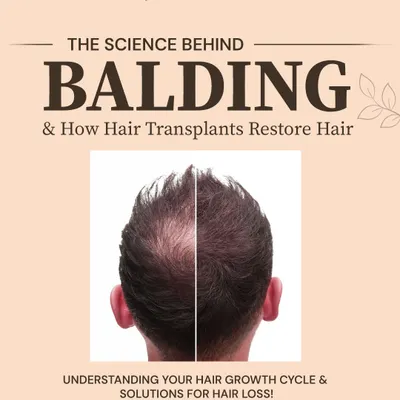 This graphic introduces the science behind balding. Understanding your hair growth cycle and the factors that disrupt it is the first step toward finding an effective solution.