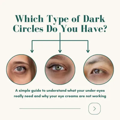 Not all dark circles are the same, which is why your eye cream might not be working. This simple guide will help you understand what your under-eyes really need by identifying the type of dark circle you have.