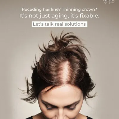 A receding hairline or a thinning crown is not just a sign of aging; it is a fixable medical condition. For many women, this can be distressing, but we have real, effective solutions to address it. Let's talk about how we can help.