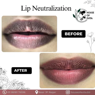 A close-up of a Dark Lip Correction, also known as Lip Neutralization. I used specialized pigments to counteract the darker tones, resulting in a much more even and healthy-looking lip color.