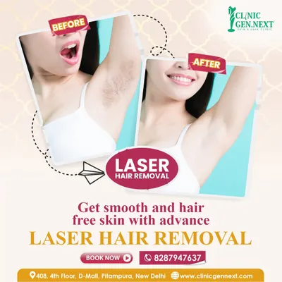 This before and after image clearly demonstrates the significant reduction in underarm hair after our advanced laser treatment. The result is smooth, clear skin, eliminating the need for constant shaving or painful waxing and preventing issues like ingrown hairs.
