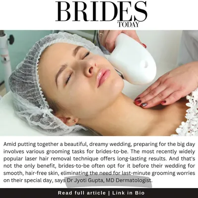 Being featured in Brides Today for my expertise on pre-wedding treatments was an honor. For brides, laser hair reduction is a game-changer, eliminating the last-minute stress of waxing or shaving during wedding events. I help you plan your sessions for smooth, worry-free skin on your special day.