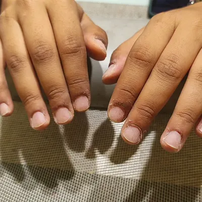 This is the 'before' shot of a client with short, bitten nails. This is the starting point for so many amazing transformations.