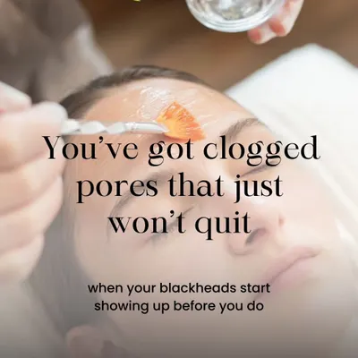 If you have clogged pores that just won't quit, it's a clear sign your skin needs professional attention. A medical facial can deeply cleanse and reset your skin in a way that at-home products cannot.