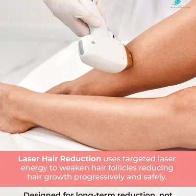 My Laser Hair Reduction treatment uses targeted laser energy to progressively and safely weaken hair follicles. It is designed for long-term reduction, providing a lasting solution beyond temporary removal methods.