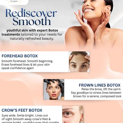 This guide breaks down the most common areas for Botox. I use it to soften dynamic wrinkles like forehead lines, frown lines, and crow’s feet, resulting in smoother skin while maintaining natural expression.