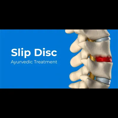 This is a duplicate of ID 18, illustrating the area affected by a slip disc. My Ayurvedic treatment offers a drug-free and non-surgical path to recovery. Therapies like Kati Basti and herbs like Dashamool ease inflammation and nourish the spinal structures to support natural healing.