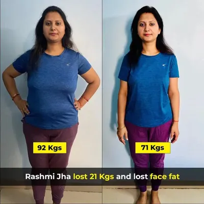 This is Rashmi, who lost an incredible 21 kgs in 6 months. Her journey is a testament to how consistency with simple home-cooked meals and manageable workouts can lead to life-changing results. I'm incredibly proud of her dedication.