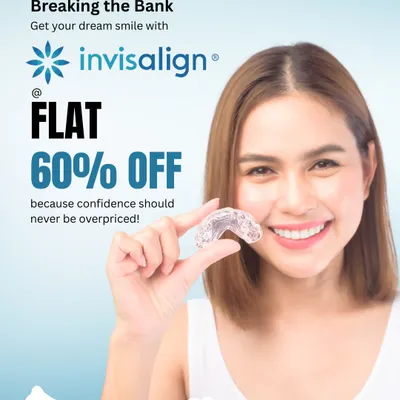 For those seeking a straighter smile without traditional braces, I offer Invisalign clear aligners. This image highlights the discreet and effective nature of the treatment, which is a removable and comfortable alternative for teeth straightening.