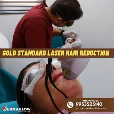A close-up view of a facial laser hair removal session. The client is wearing protective eyewear, and our trained professional is precisely targeting unwanted hair on the upper lip, demonstrating our commitment to a safe and controlled procedure.