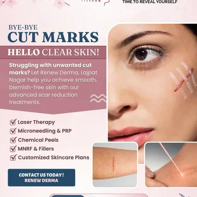 Say goodbye to cut marks and hello to clear skin. This graphic outlines our advanced scar reduction treatments, including Laser Therapy, Microneedling with PRP, Chemical Peels, and MNRF, all customized to help you achieve smooth, blemish-free skin.