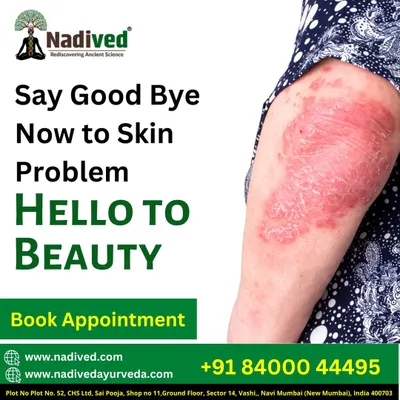 Skin problems are rarely just skin-deep. Ayurveda teaches us that issues like eczema and psoriasis are manifestations of internal toxicity. My treatment focuses on blood purification and balancing doshas to heal your skin from within.