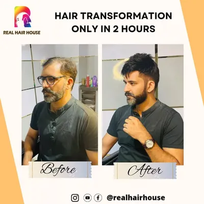 A stylish transformation for a modern look. I focus on cutting and blending the hair system to match your face shape and personal style, ensuring the final result is both natural and fashionable.