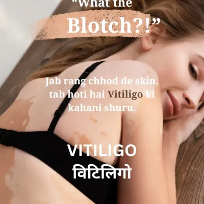 This graphic introduces vitiligo, a condition where the skin begins to lose its color, creating white patches. We believe in spreading awareness and providing supportive care for those affected.