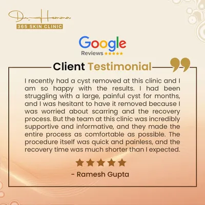 I was so happy to receive this review from a patient after his cyst removal. He was initially hesitant due to worries about pain and scarring, but my team and I made sure he was comfortable throughout the quick procedure. His experience reflects my commitment to patient care.