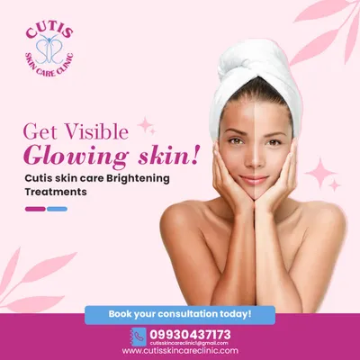 This before-and-after graphic demonstrates the visible results of my skin brightening treatments. I design these procedures to combat dullness and pigmentation, helping you achieve a significantly brighter and more glowing complexion.