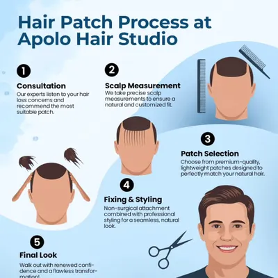 We believe in a clear and professional process. This infographic outlines our five steps to a flawless transformation, including consultation, scalp measurement, patch selection, fixing, and final styling.