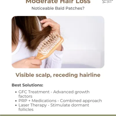 If you're noticing moderate hair loss, a visible scalp, or a receding hairline, we have solutions. Laser therapy is one of the best options to stimulate dormant follicles.