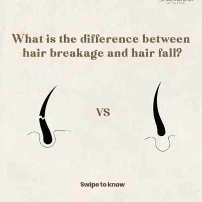 The initial step in any hair restoration journey is to determine whether you are experiencing hair fall or hair breakage. This simple visual illustrates the fundamental difference, which is crucial for developing an effective treatment strategy.