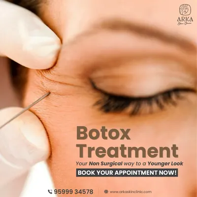 This is a close-up of a Botox treatment, a non-surgical way to achieve a younger look. It works by relaxing the muscles that cause expression lines, resulting in smoother skin. The procedure is quick, safe, and highly effective.