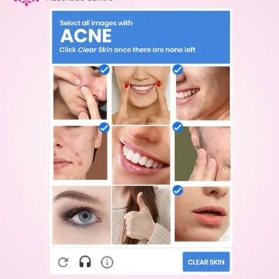 Tired of playing this game with your skin? You don't have to. I provide effective, science-backed treatments to clear acne for good, so you can feel confident in your skin every day.