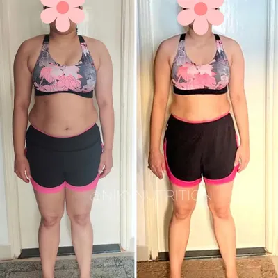 This is what a one-year fat loss journey looks like. This client dealt with PCOS, a hectic work schedule, and steroid-induced weight gain, but through consistent effort with a flexible Indian diet plan and regular workouts, she achieved incredible results.