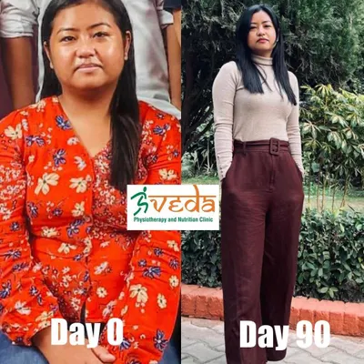 In just 90 days, this client lost 10kgs and resolved her stomach issues. Her transformation shows how well the body responds to a consistent, tailored diet plan, resulting in significant inch loss and improved well-being.