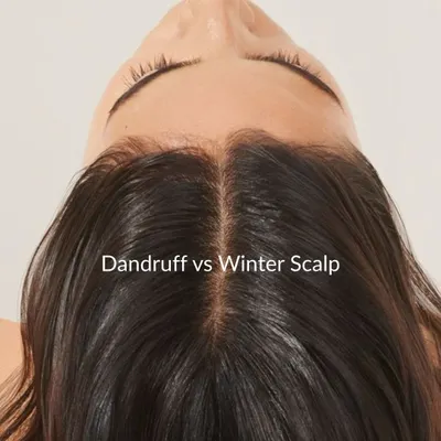Before you reach for an anti-dandruff shampoo, let's determine what is really going on. This image introduces the common confusion between dandruff and a dry winter scalp, a distinction our trichologists are experts at diagnosing.