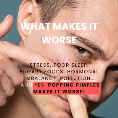 Popping pimples is one of the worst things you can do for your skin as it spreads bacteria and guarantees scarring. I work with patients to understand all their acne triggers, from stress and diet to hormonal imbalances, for a holistic treatment plan.
