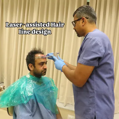 The first step to a natural result is a perfectly designed hairline. Here, I am using a laser hairline device to ensure absolute symmetry and precision, creating an age-appropriate and aesthetically pleasing frame for the patient's face.