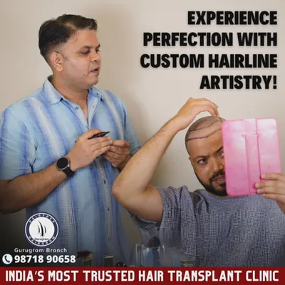 The first step in creating a great result is designing a great hairline. Here, I'm working with a patient to map out a hairline that is both natural and perfectly suited to his facial features.