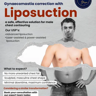 This graphic outlines what you can expect from a gynecomastia correction with liposuction. We use advanced, laser-assisted techniques to sculpt a masculine chest shape with minimal downtime, so you can stop hiding under baggy shirts.