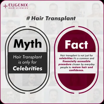Myth: Hair transplant is only for celebrities. Fact: This is a common misconception. Hair restoration is an accessible and common procedure chosen by people from all walks of life to restore their hair and confidence. We make world-class results available to everyone.
