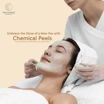 A client relaxes while receiving a professional chemical peel. This treatment is tailored to their skin type to gently remove dead cells, unclog pores, and improve overall tone and texture for a fresh, renewed look.