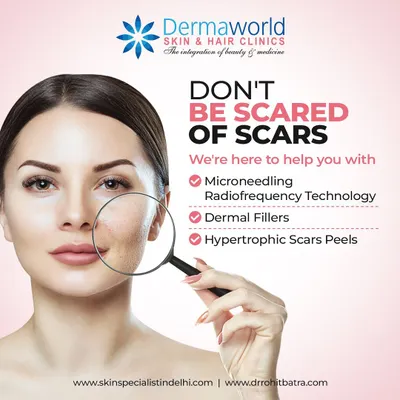 Don't be scared of scars. I offer several effective treatments to significantly improve their appearance. My methods include Microneedling RF to stimulate collagen, dermal fillers to lift depressed scars, and specialized peels for hypertrophic or raised scars.