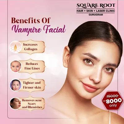 An overview of the benefits of a Vampire Facial, or PRP treatment. It increases collagen, reduces fine lines, tightens skin, and helps remove acne scars and blemishes.