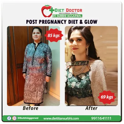 This before-and-after shows a 16 kg post-pregnancy weight loss, from 85 kgs to 69 kgs. The focus was on a balanced diet that supports healing and provides a natural, healthy glow.