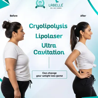 This is the power of a personalized transformation. By combining advanced, non-surgical treatments like Cryolipolysis, Lipolaser, and Ultra Cavitation, we help you achieve visible inch loss and a sculpted, toned physique.