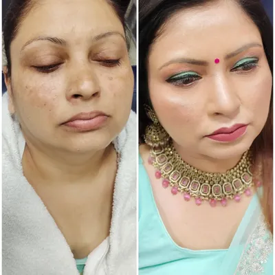 This is the power of good makeup technique. On the left is the before, and on the right is the after, with all blemishes and pigmentation corrected for a smooth, event-ready finish.