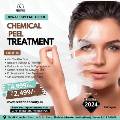 A Diwali special offer on our Chemical Peel Treatment. This is a professional and safe treatment to get youthful skin, remove dullness, reduce acne scars, and achieve a smooth, even skin tone.
