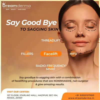 This visual guide shows the different non-invasive procedures I combine for a complete facelift effect, targeting sagging skin with treatments like Threadlift, Fillers, HIFU, and MNRF.