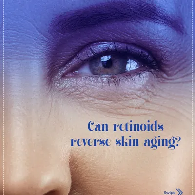 Can retinoids truly reverse skin aging? While they are excellent for smoothing fine lines and preventing premature aging, they cannot fully reverse deep-set signs of aging on their own.
