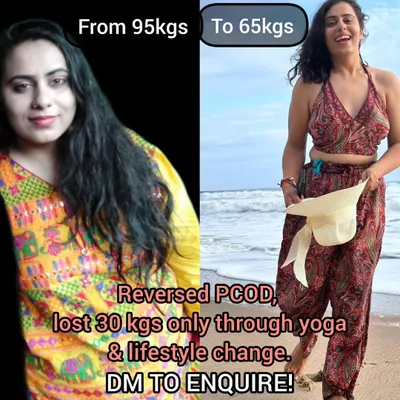 My own journey is proof that traditional yoga works. I reversed my PCOD and lost 30 kgs not with extreme diets or workouts, but with a consistent yoga practice and lifestyle changes. This is the path I guide my students on.