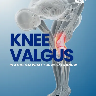 An introduction to Knee Valgus, a common movement dysfunction in athletes that can lead to significant injury if not addressed.