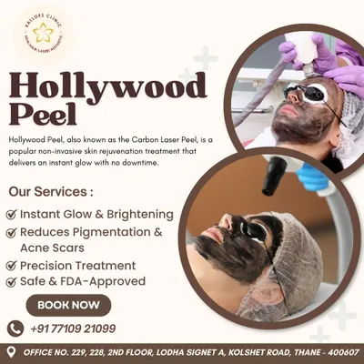 The Hollywood Peel is a non-invasive treatment that delivers an instant glow and is safe for all skin types. As shown here, it is a comfortable procedure that effectively brightens the skin and reduces the appearance of pores and minor imperfections.