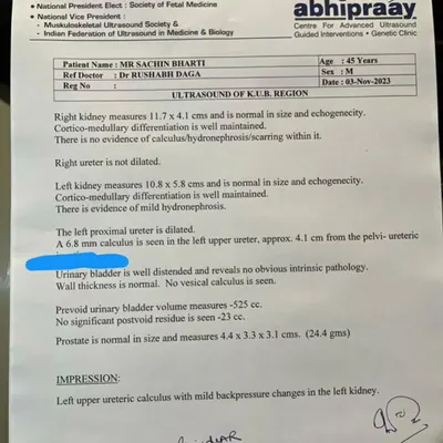 **Before Treatment:** This patient's initial ultrasound report from November 2023 confirmed a 6.8 mm calculus, or stone, in the left ureter. This is a common and painful condition that often leads doctors to recommend surgery.