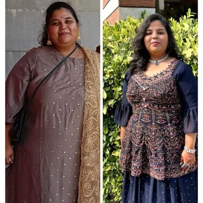 I am so proud of Varsha's journey. This before and after photo shows her incredible 20 kg weight loss over 6 months. Her commitment to her personalized diet plan shows that real results are possible.