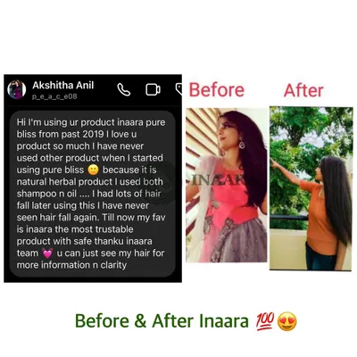 A journey from significant hair fall to healthy, thriving hair. This client has been using my Pure Bliss oil and shampoo since 2019, and her results speak for themselves. This is the power of sticking to a natural, chemical-free routine.