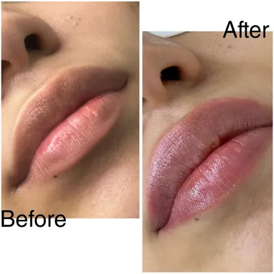 This shows how beautifully a lip blush heals after the first sitting. The color has softened into a subtle, natural tint that defines the lip border and adds a healthy glow.