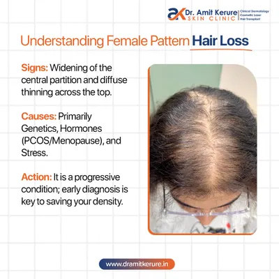 This infographic helps you understand the signs of Female Pattern Hair Loss. Key indicators include a widening central partition and diffuse thinning. It's a progressive condition, so early diagnosis is crucial to saving your hair density.